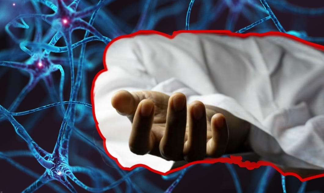 GBS Syndrome Outbreak